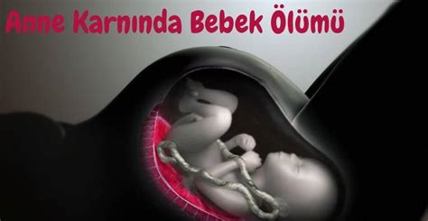 anne karnında 4 aylık bebek ölümü belirtileri kadınlar kulübü